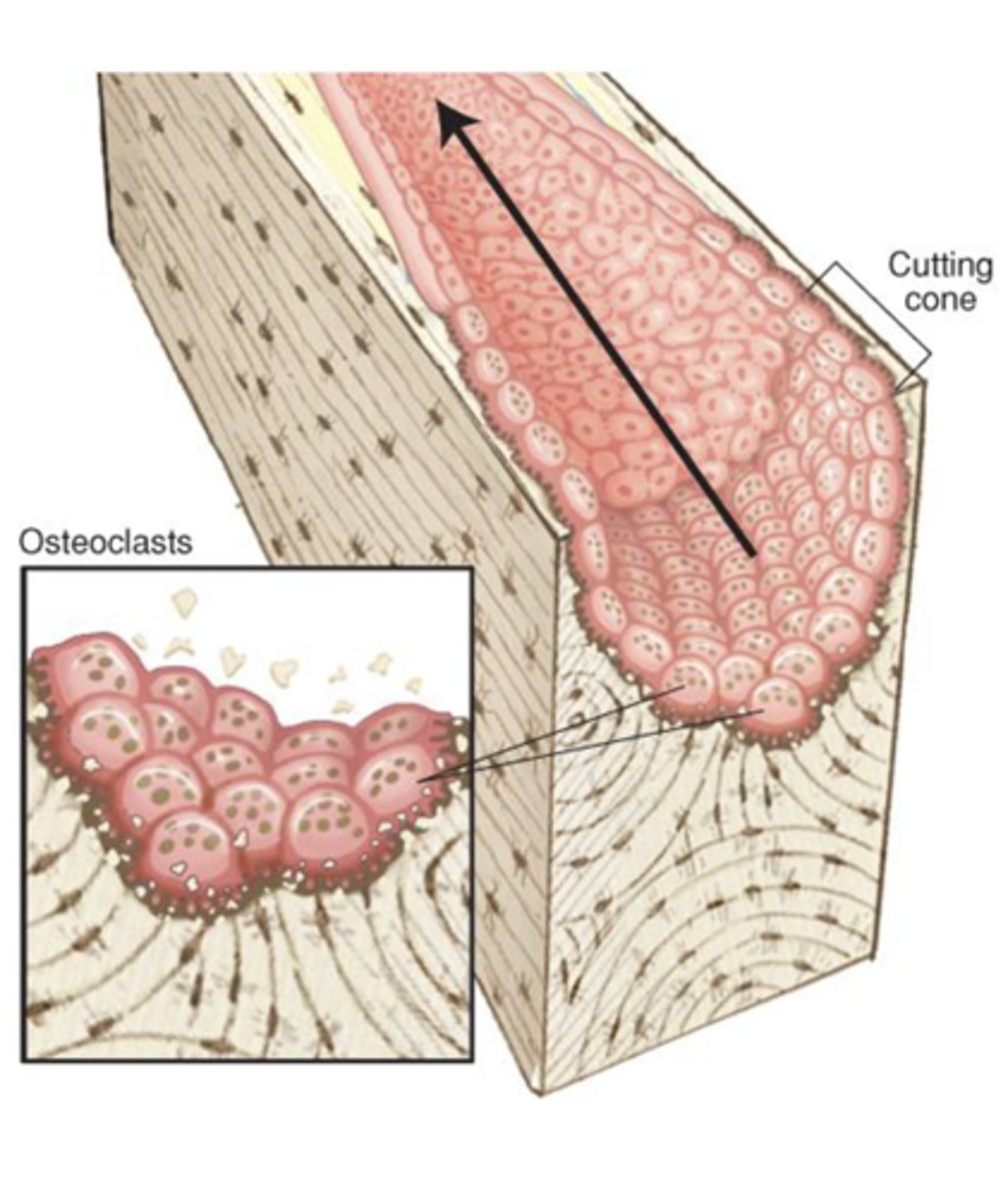<p>1. ___________ resorption of existing bone</p><p>Organic and inorganic components are removed, creating a _______-______ space in the osteon</p><p>Soluble factors (e.g. OPG) released during resorption aid in the recruitment of osteoblasts to the site</p><p>("__________")</p>