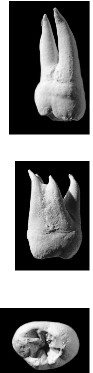 <p>Which Tooth is this?</p>