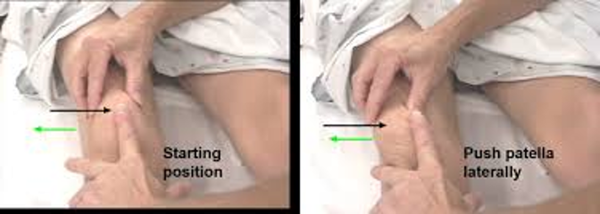 <ul><li><p>pt supine w/ legs flat on table and quads relaxed → try to dislocate patella laterally </p></li><li><p>positive = apprehensive or asks to stop (prone to patellar dislocations)</p></li></ul><p></p>