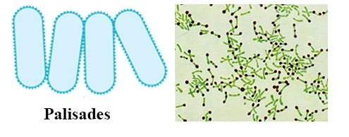 <p>bacilli side by side like a picket fence </p>