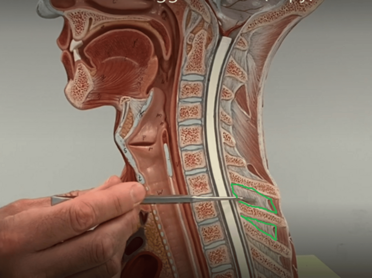 <p>found inferior to C7</p>