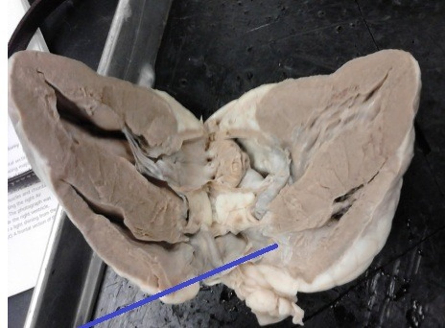 <p>Identify the valve.</p>