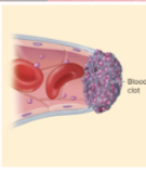 <p>most effective defense against bleeding</p><ul><li><p>conversion of fibrinogen (ogen=precursor to something else) to fibrin threads to form framework of clot</p></li><li><p>Procoagulants (clotting factors)— usually made by liver; present in plasma</p><ul><li><p>activate one factor, it activates next.. reaction cascade</p></li></ul></li></ul><p></p>