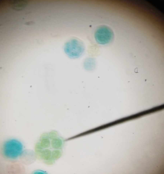 <p>Chlorophyta; common swimming freshwater green alga; simple colony type; compact ball of cells kept together by a gelatinous envelope</p>