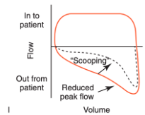 <p>What does scooping indicate?</p>