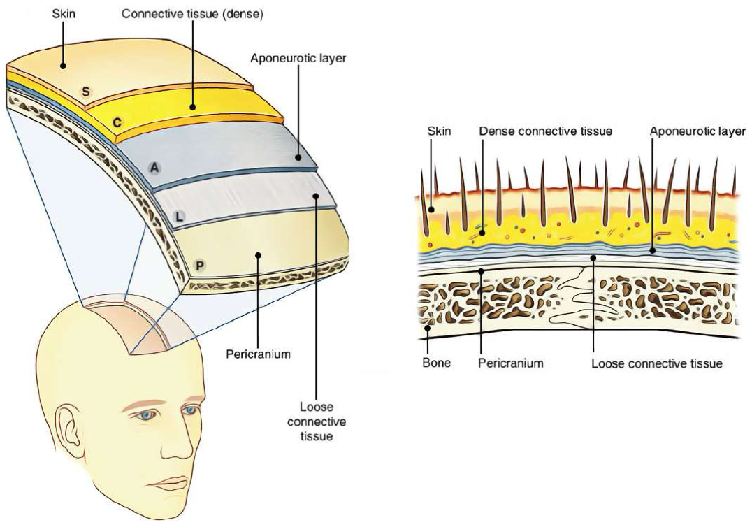 <p>Lo Scalpo → rivestimento del cranio:</p><ul><li><p>5 strati</p></li><li><p>Diverso dal cuoio capelluto che riguarda solo i primi 3 strati superficiali (S-C-A)</p></li><li><p>Infatti i pellerossa (indiani d’America) prelevavano il cuoio capelluto e non tutto lo scalpo alle proprie vittime come trofeo</p></li></ul><p>Gli Strati:</p><ul><li><p>S → Skin </p><ul><li><p>pelle con capelli</p></li></ul></li><li><p>C → Connettive tissue </p><ul><li><p>tessuto connettivo denso sottocutaneo (ricco di vasi e nervi)</p></li></ul></li><li><p>A → Aponeurotic Layer</p><ul><li><p>indica la galea aponeurotica, un tendine piatto che unisce muscoli frontali e occipitali</p></li></ul></li><li><p>L → Loose Connective tissue </p><ul><li><p>tessuto connettivo lasso, piano di scorrimento che permette i movimenti dello scalpo</p></li></ul></li><li><p>P → Pericranium</p><ul><li><p>periostio che ricopre le ossa craniche</p></li></ul></li><li><p>(O) → Osso</p><ul><li><p>non fa parte dello scalpo, ma è subito sotto</p></li></ul></li></ul><p></p>