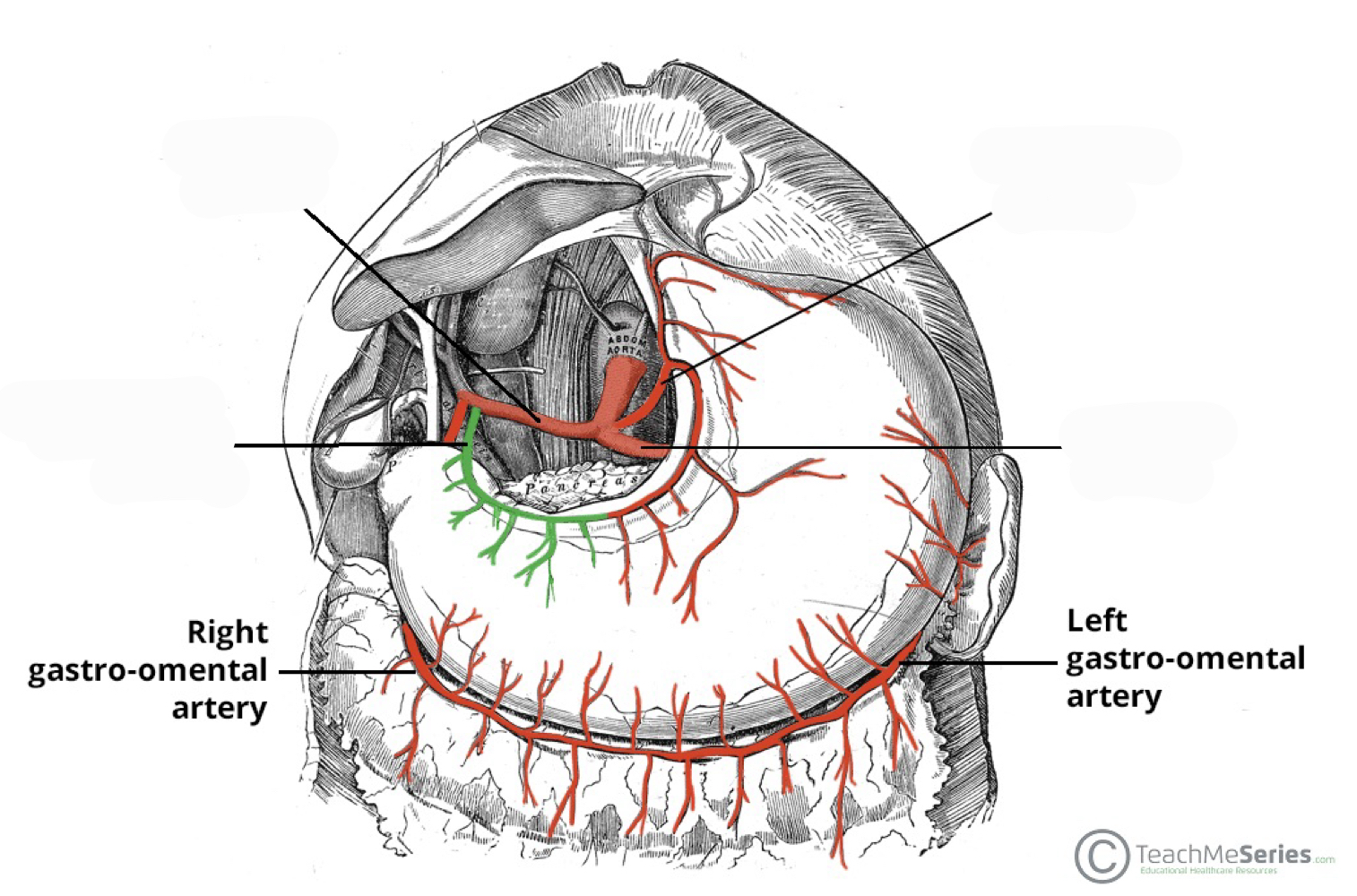<p>right and left gastroomental arteries</p>