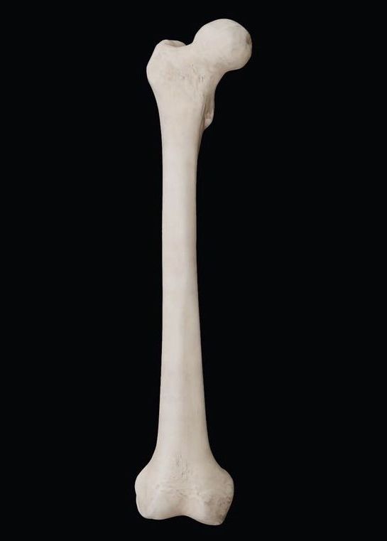 <p>Where is the head of the femur?</p>