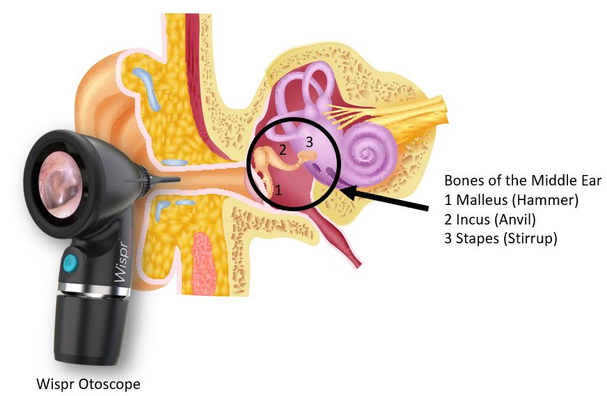 <p><strong><u>Audition (Mod 20)</u></strong></p><p>It is made up of 3 tiny bones; <strong>hammer, anvil, and stirrup (malleus, incus, and stapes</strong> in Latin, or the ossicle bones) that pick up vibrations and transmit them to the <strong>cochlea</strong></p>