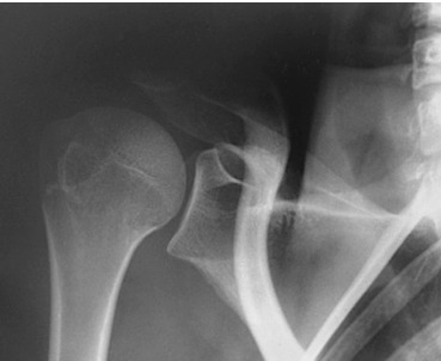 <p>1. What projection is shown in the image?</p><p>2. What are the clinical indications for this projection?</p><p>3. Is this an optimal image?</p><p>4. Name all of the anatomy.</p><p>5. Does this image meet all criteria?</p><p>6. Where is the CR placed?</p><p>7. If applicable, what method is interchangeable with this projection?</p>