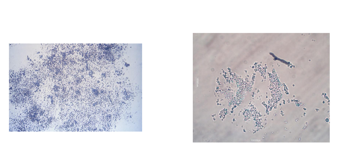 <p><span>Alkaline pH and heavy white precipitate after</span></p><p><span>refrigeration</span></p><p><span style="font-family: Arial, sans-serif">Granular in appearance</span></p>