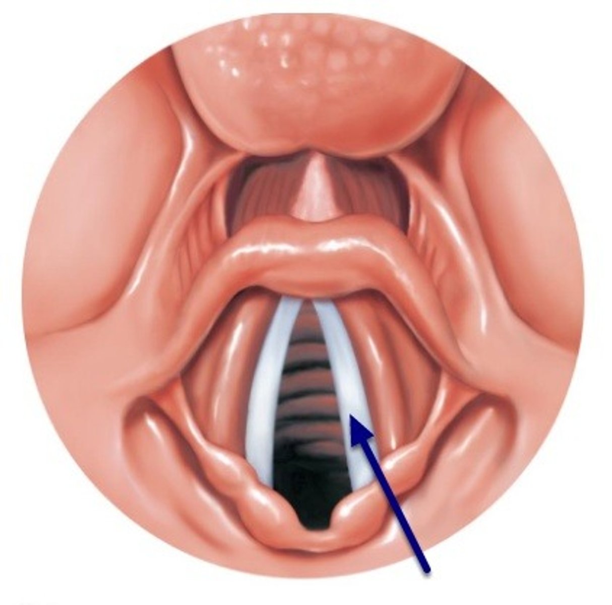 <p>true vocal cords made of <strong>elastic tissue</strong> and <strong>stratified squamous lining</strong></p><p>- <strong>tension/tautness on vocal cords</strong> from the <span class="bgY">extrinsic &amp; intrinsic muscles of the larynx</span> controls <strong>pitch</strong></p><p>- the <strong>amount of air passing</strong> through the vocal cords <strong>controls volume</strong></p><p></p><p><strong>vibration of the vocal cords create sound</strong></p><p></p><p>men's vocal cords are thicker; during puberty testosterone enlarges </p>