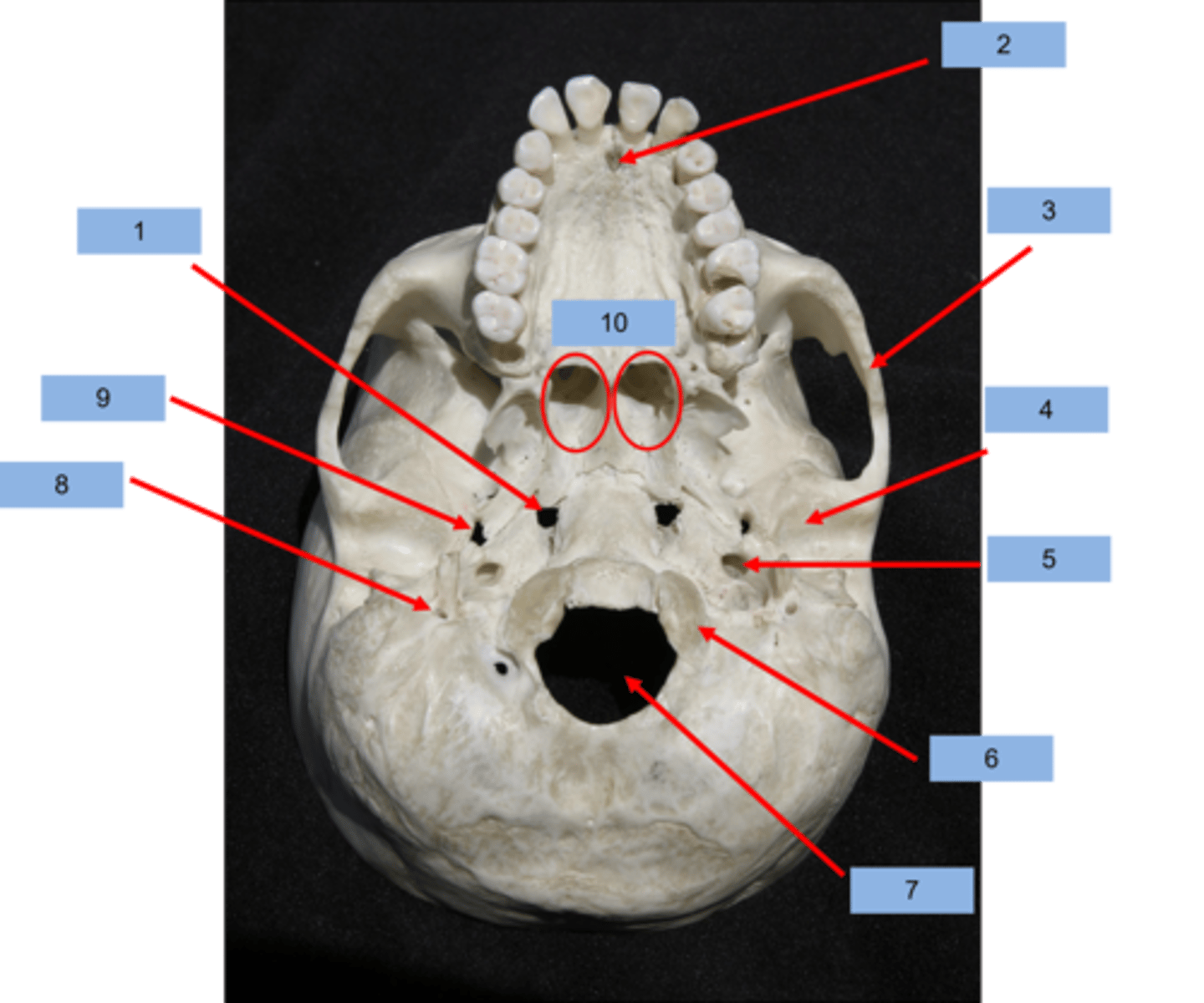 <p>What is #4 pointing to?</p>