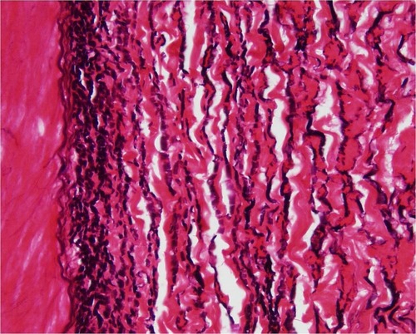 <p>(Dense)</p><p>- Allows stretch/re-coil of large arteries</p><p>- Found in aorta</p><p>---- When Identifying, the elastin fibers look like ramen noodles or cut rubber bands and they stain dark</p>
