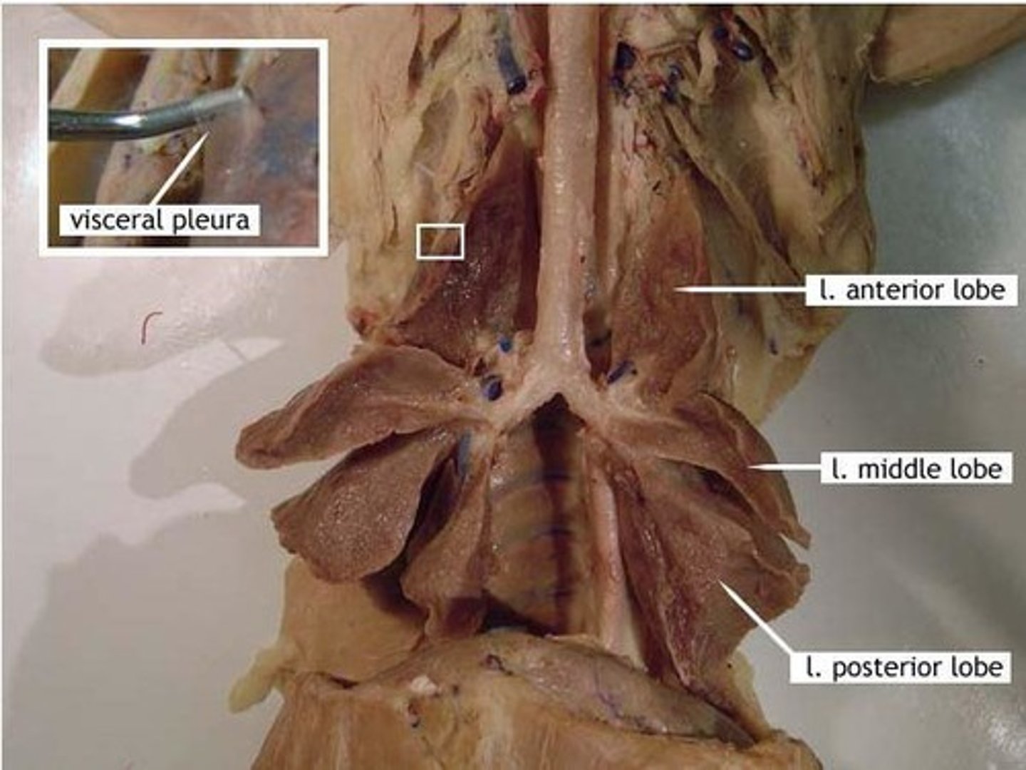 <p>3 lobes (anterior, middle, posterior)</p>