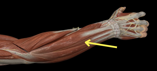 term image