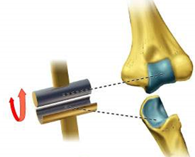 <p>What type of joint is this?</p>