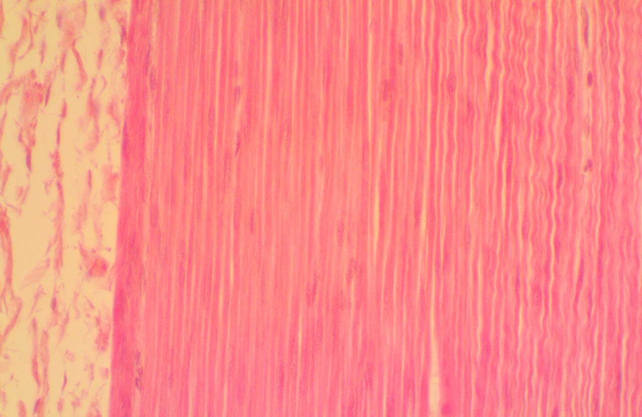 <p>Smooth muscle</p>