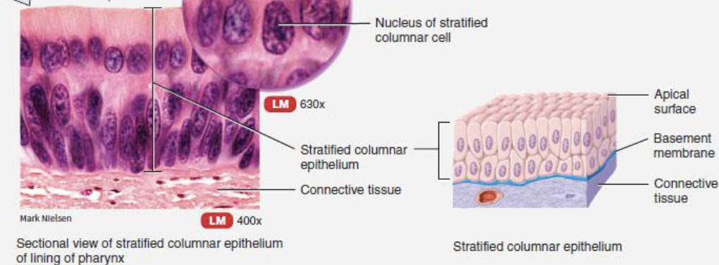 <p>basal layers are shortened, irregularly shaped cells, only apical layer has columnar cells</p>