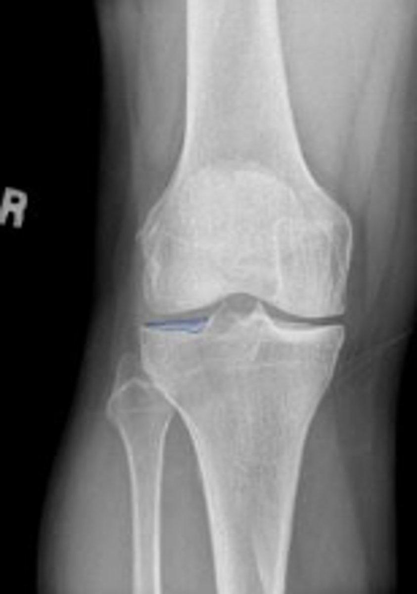 <p>What is outlined?</p>