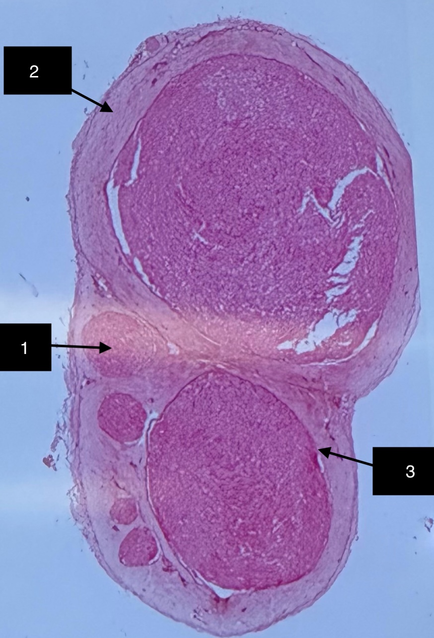 <p>2</p>