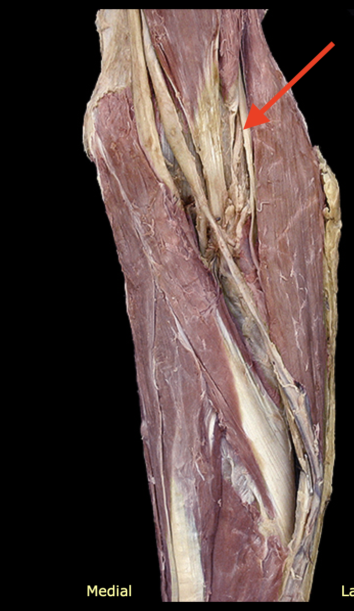 <p>Structure</p>