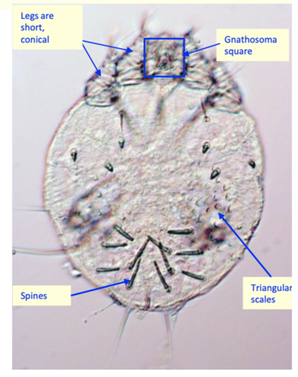 <p>• Shape of the body: oval/circular, ventral surface is</p><p>flattened while the dorsal surface is convex; </p><p>• Gnathosoma: almost square;• On the dorsal side of idiosoma there are:</p><p>Transversal striations</p><p>Spines </p><p>triangular scales</p><p>The legs are short and conical:</p>