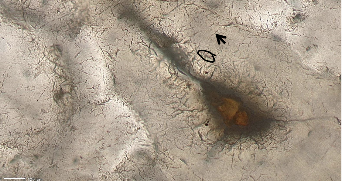 <p>ID the cell within the black circle. ID the structure at the tip of the arrow. What is found inside this structure at the arrow?</p>