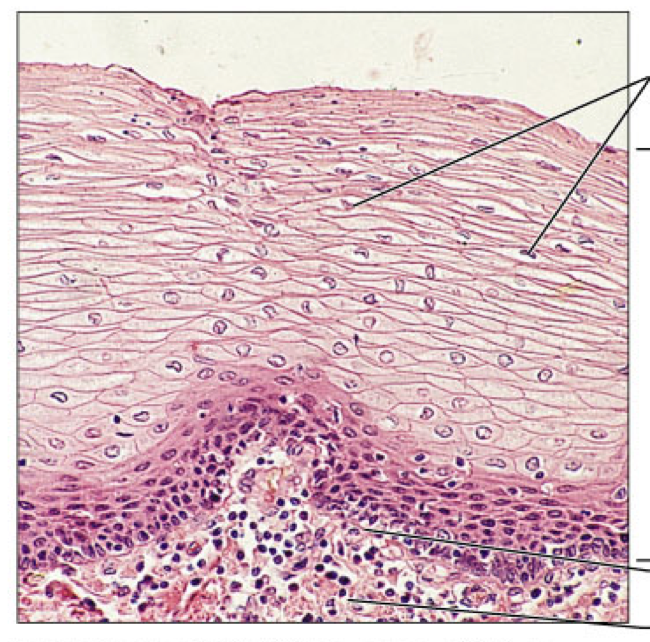 <p>stratified squamous </p>