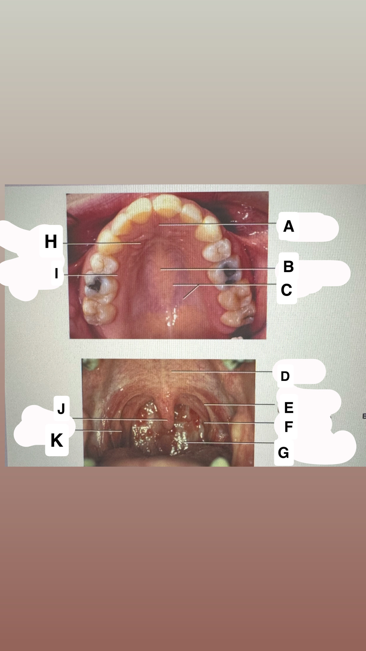 <p>Identify A</p>