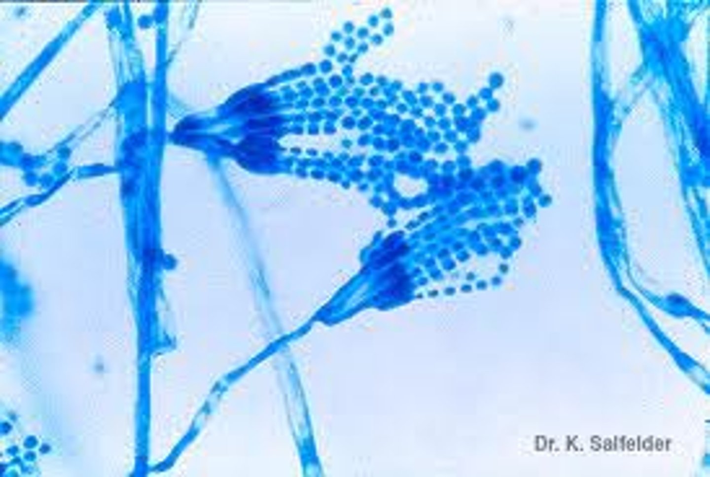 <p>Rapid; 2-3 days</p><p>Velvety-white, becomes powdery, blue green</p><p>Reverse: colorless</p><p>Microscopic: chains of phialoconidia--paint brush</p><p>Conditions: contaminant; also causes keratomycosis, penicillinosis, otomycosis, onychomycosis</p>