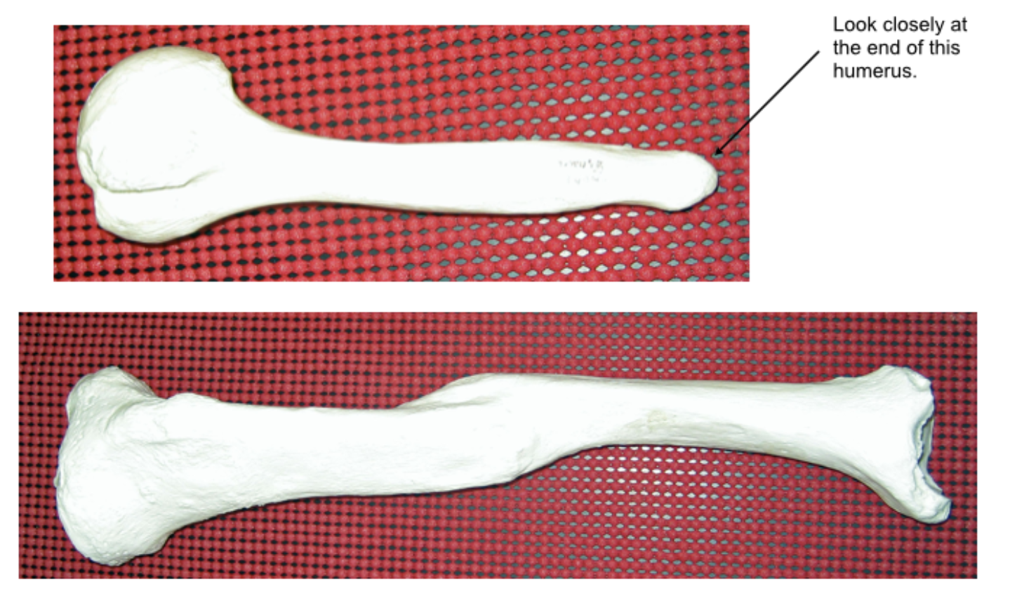 <p><span>Did these two injuries occur antemortem, perimortem, or postmortem?</span></p>