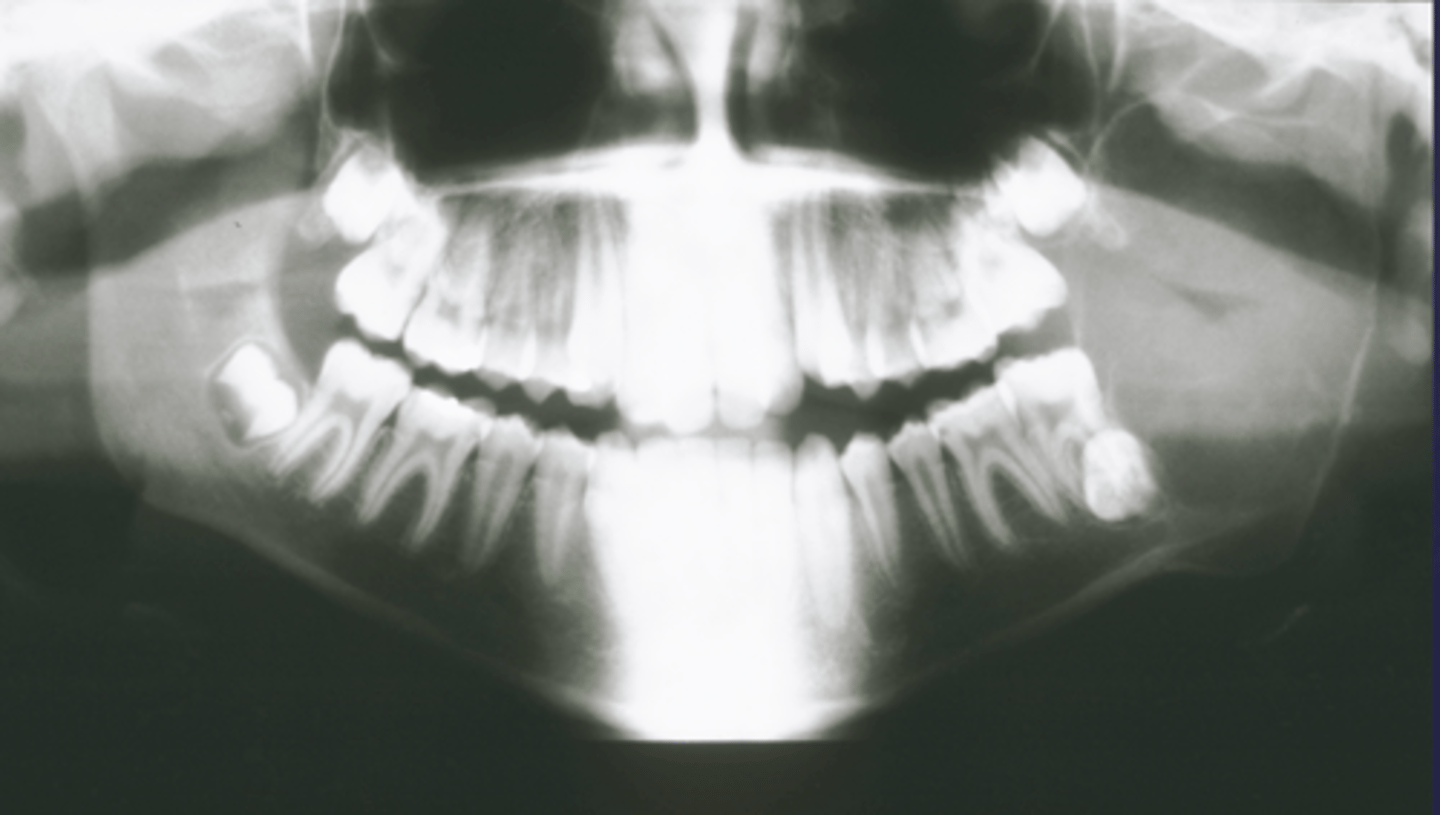 <p>How would you describe the lesion?</p>