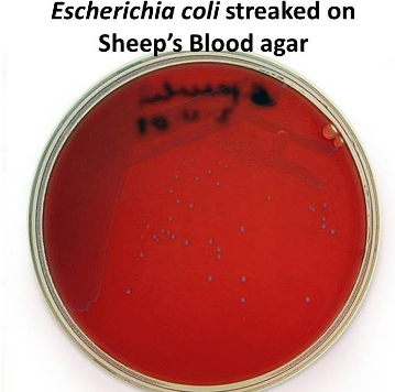 <p>Escherichia coli yields whitish colonies when grown on sheep's blood agar. What type of hemolytic pattern does this indicate?</p>