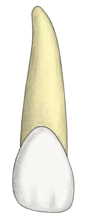 <p>Maxillary Lateral Incisor</p>