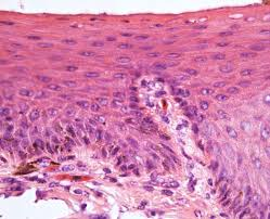 <p>Stratified squamous epithelium lacking surface keratin; must remain moist.</p>