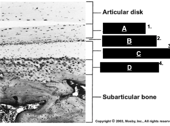 <p>identify A </p>