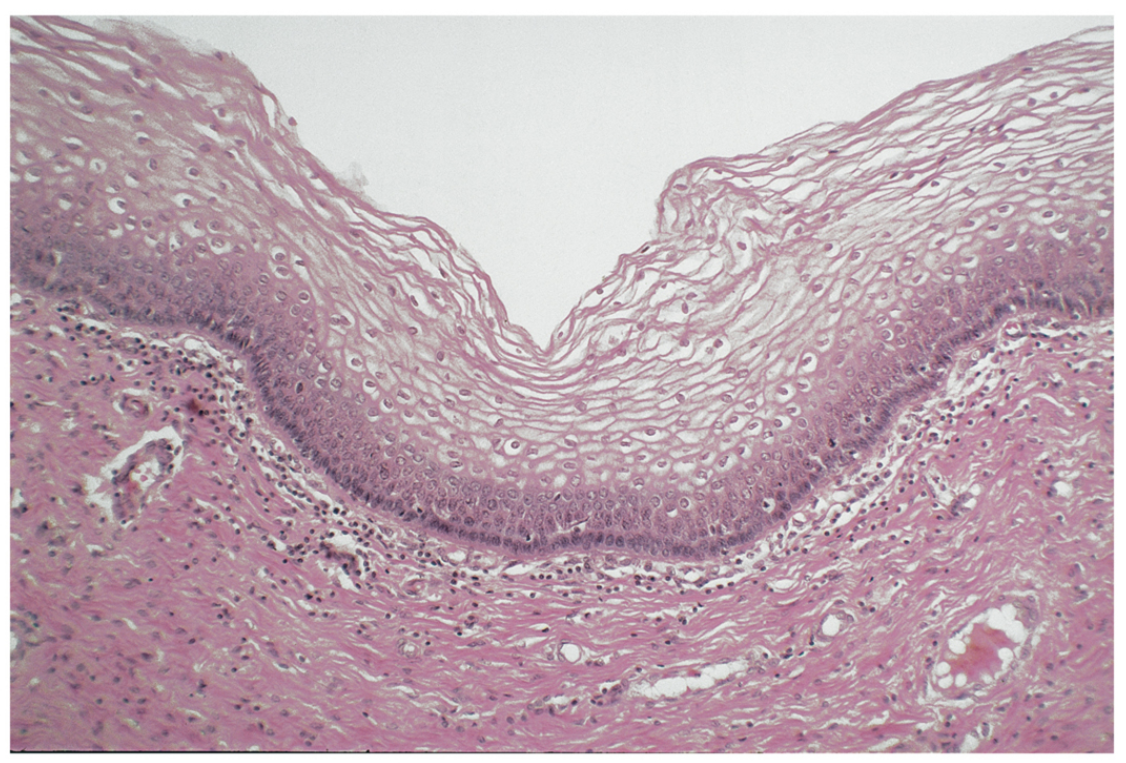 <p>Stratified squamous epithelium.</p>