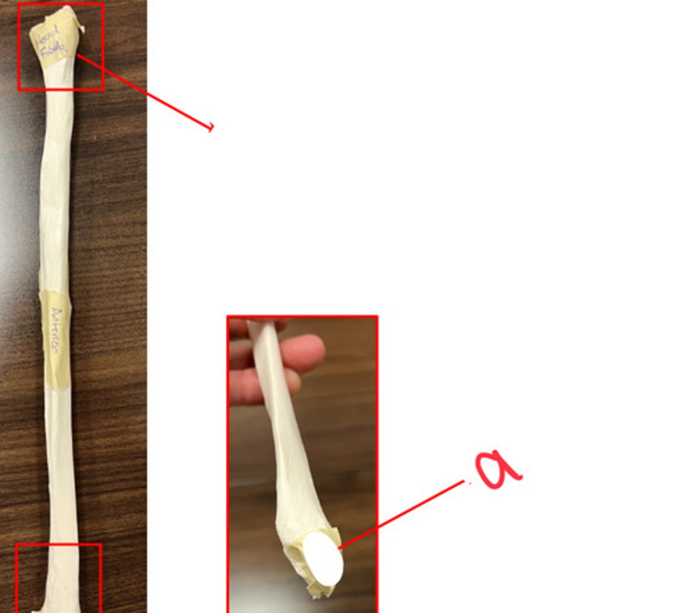 <p>what structure is labeled by a?</p>