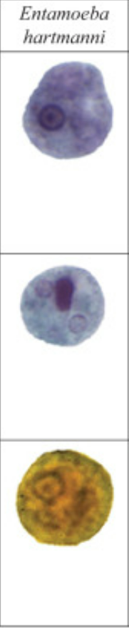 <p>Entamoeba harmanni (trophozoite sa taas, ubos ang cyst)</p>