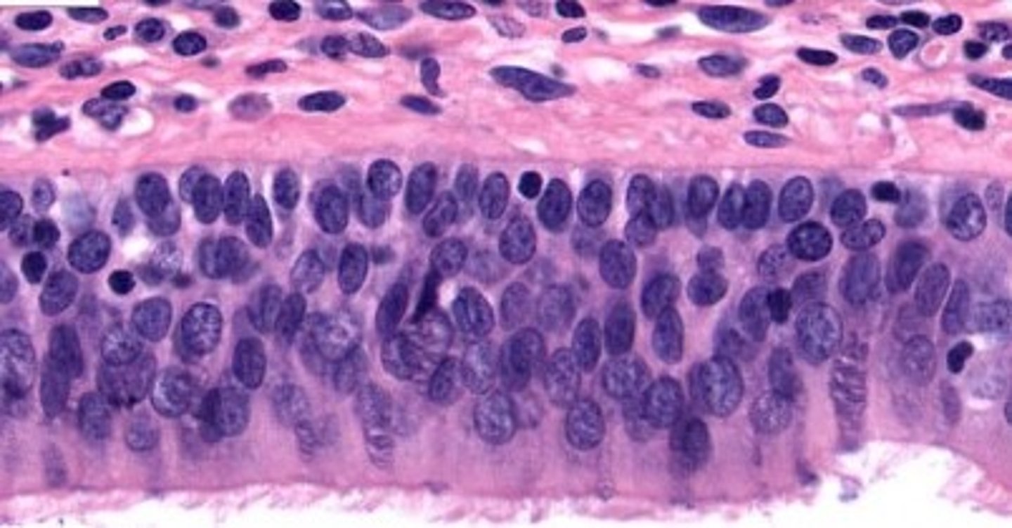 <p>posterior surface of epiglottis</p>