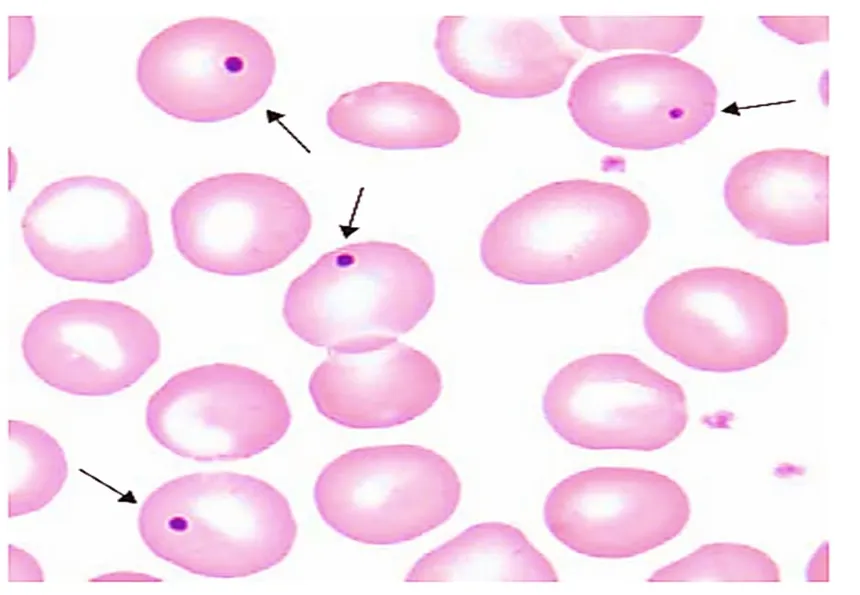 <p><span>Howell-Jolly Bodies</span></p>