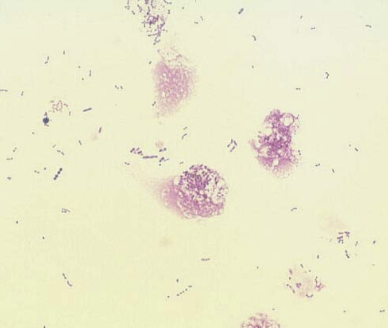 <p>cell destruction</p>