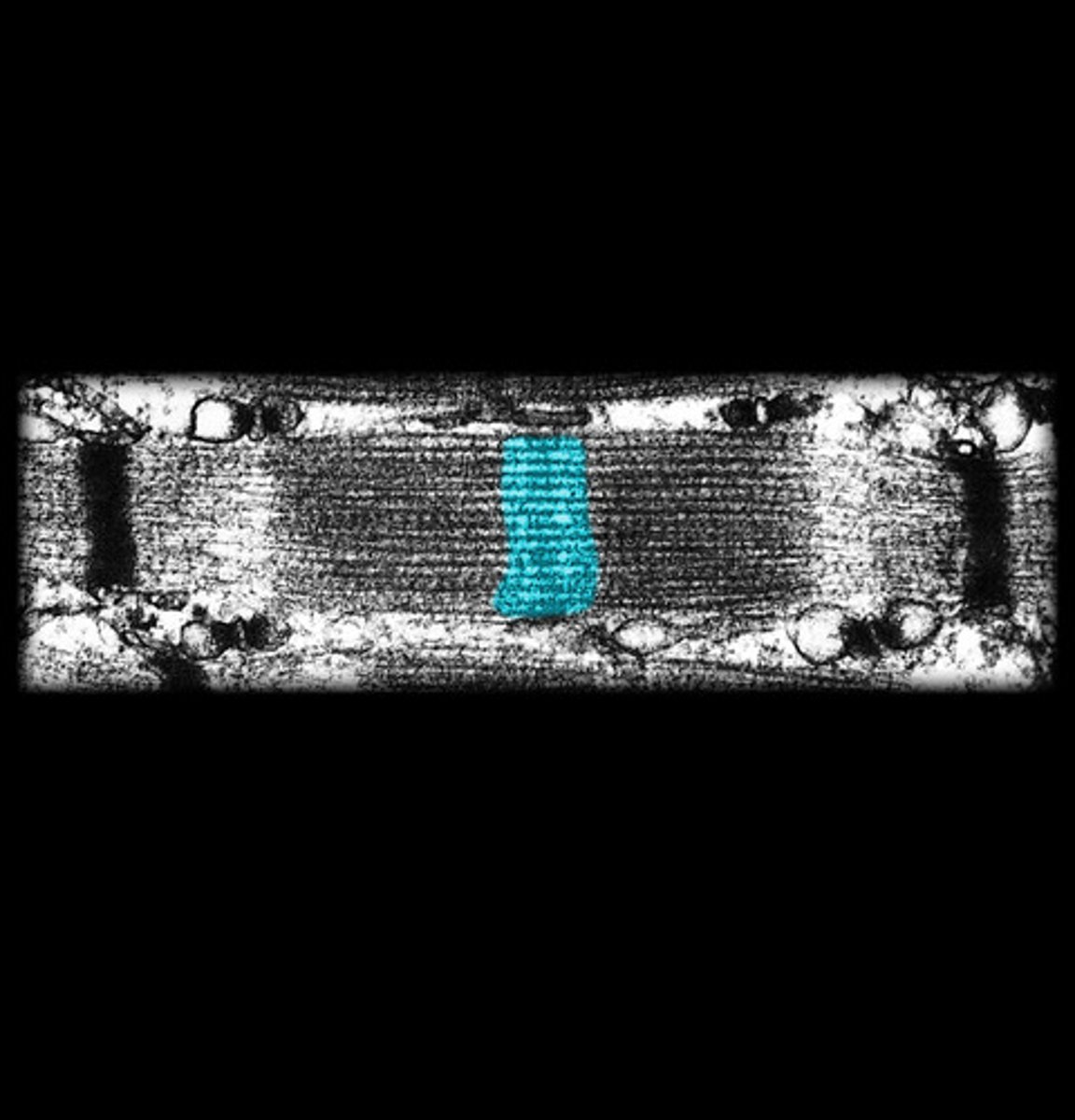 <p>myosin filaments (thick)</p>