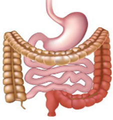 <p>what are the characteristics of ulcerative colitis?</p>