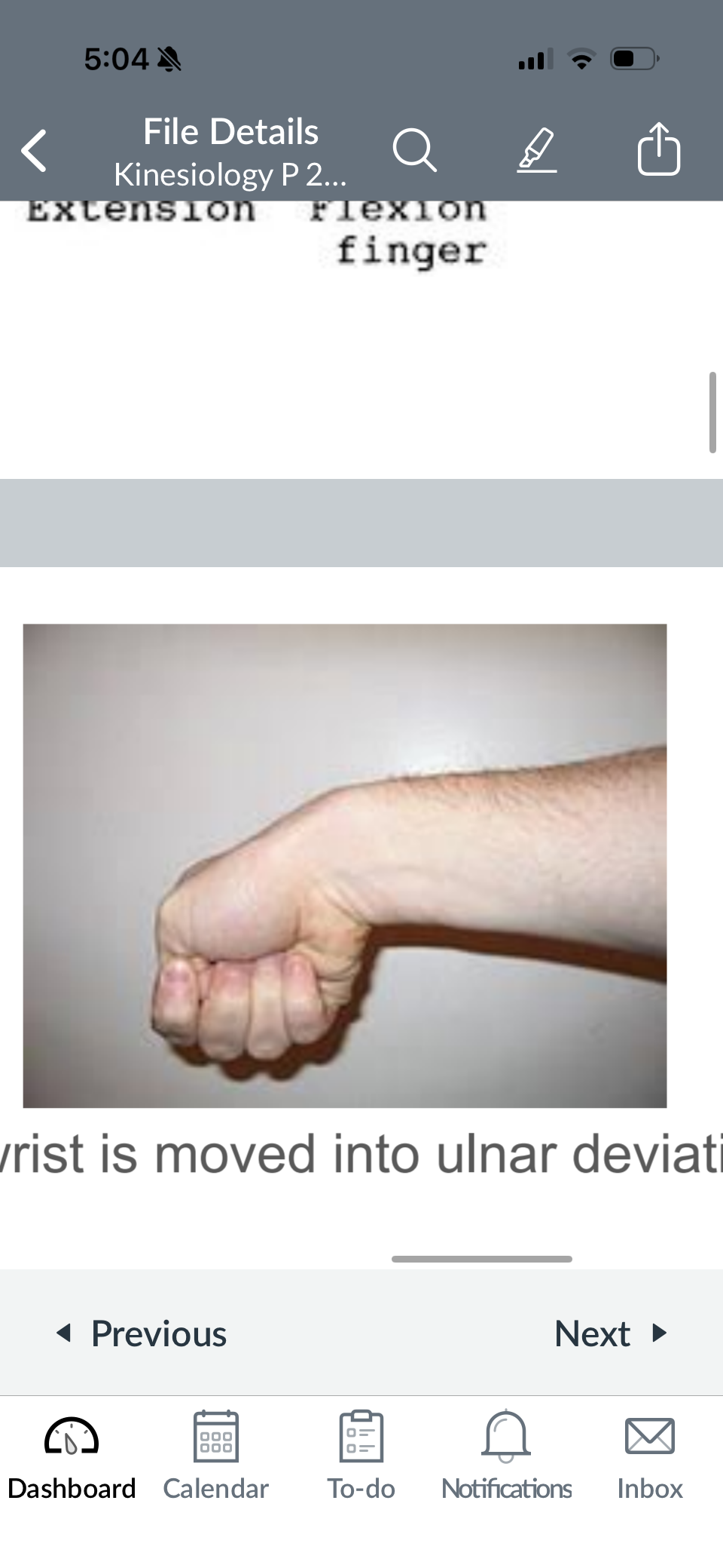 <p>A test for deQuervain's syndrome where the patient makes a fist with the thumb tucked inside, and wrist ulnar deviation is tested.</p>