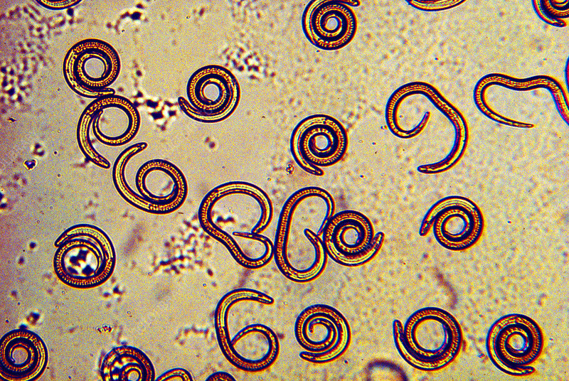 <p>in wide range of hosts, human feces</p><p>Eosinophila, muscle pain, ocular pain, pneumonia, petechial hemorrhage in conjunctiva and under nail beds</p><p>worldwide</p><p>history of eating undercooked/raw meat</p>