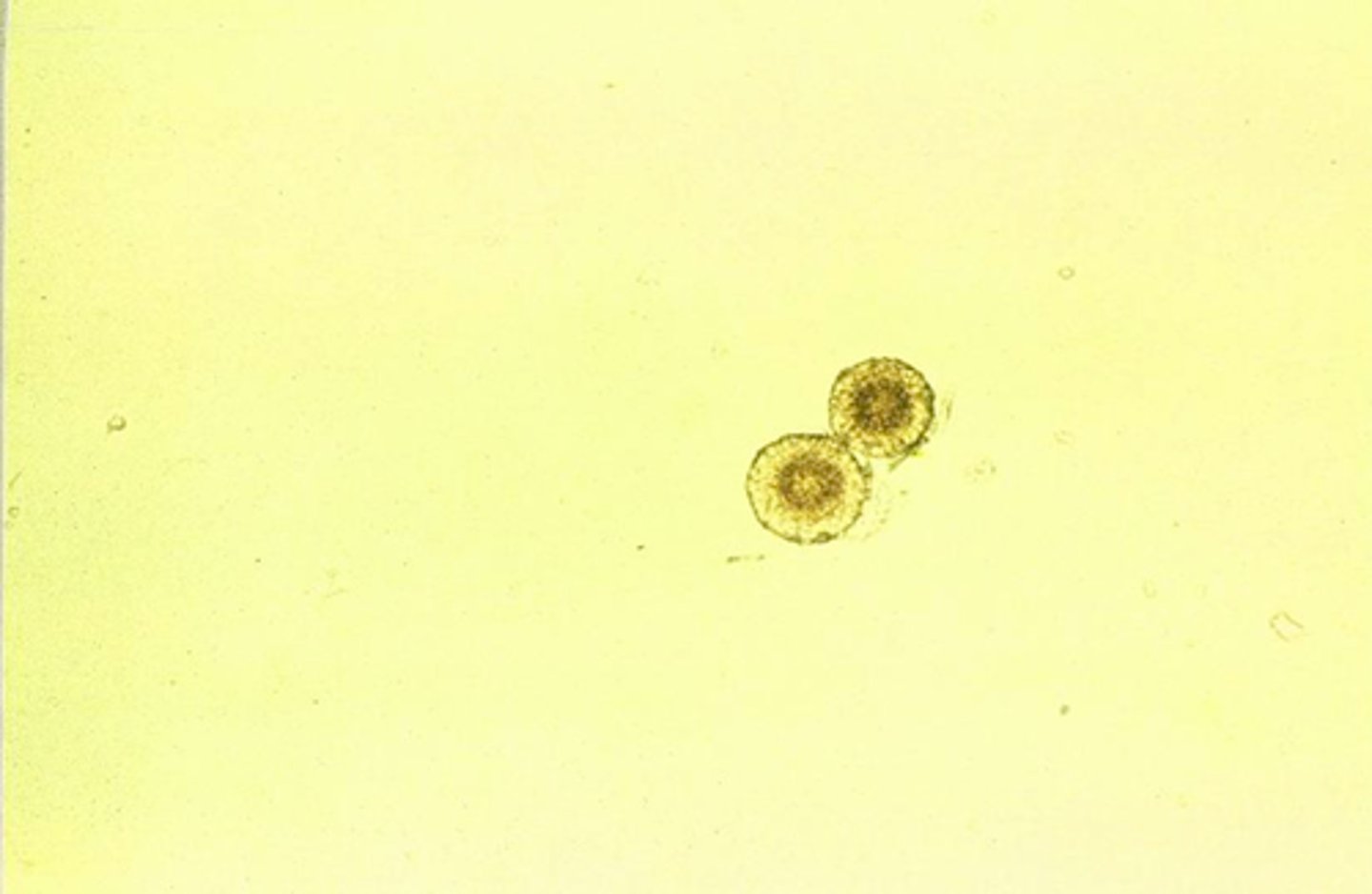 <p>Fine yellow needles in sheaves or rosettes; seen in severe liver disease</p><p>often seen w/ tyrosine</p>