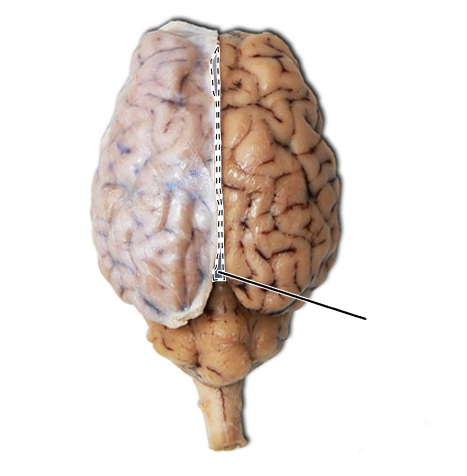 <p>What is the line down the midsagittal plane of the brain called?</p>