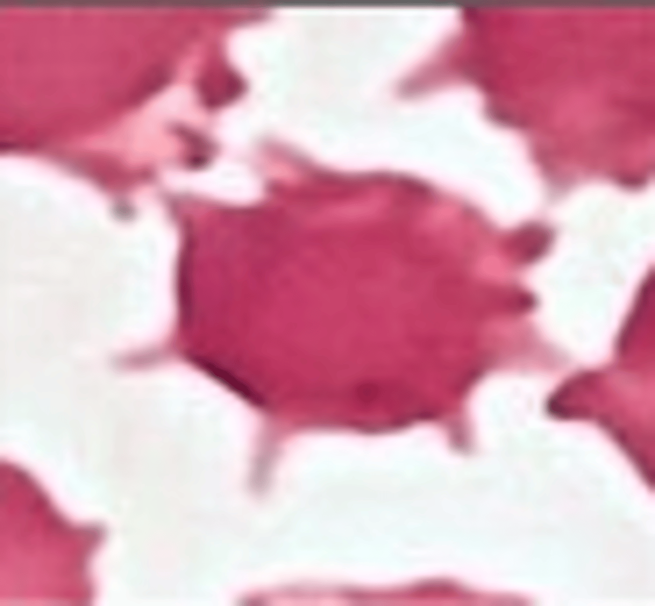 <p>What RBC morphology is this?</p>